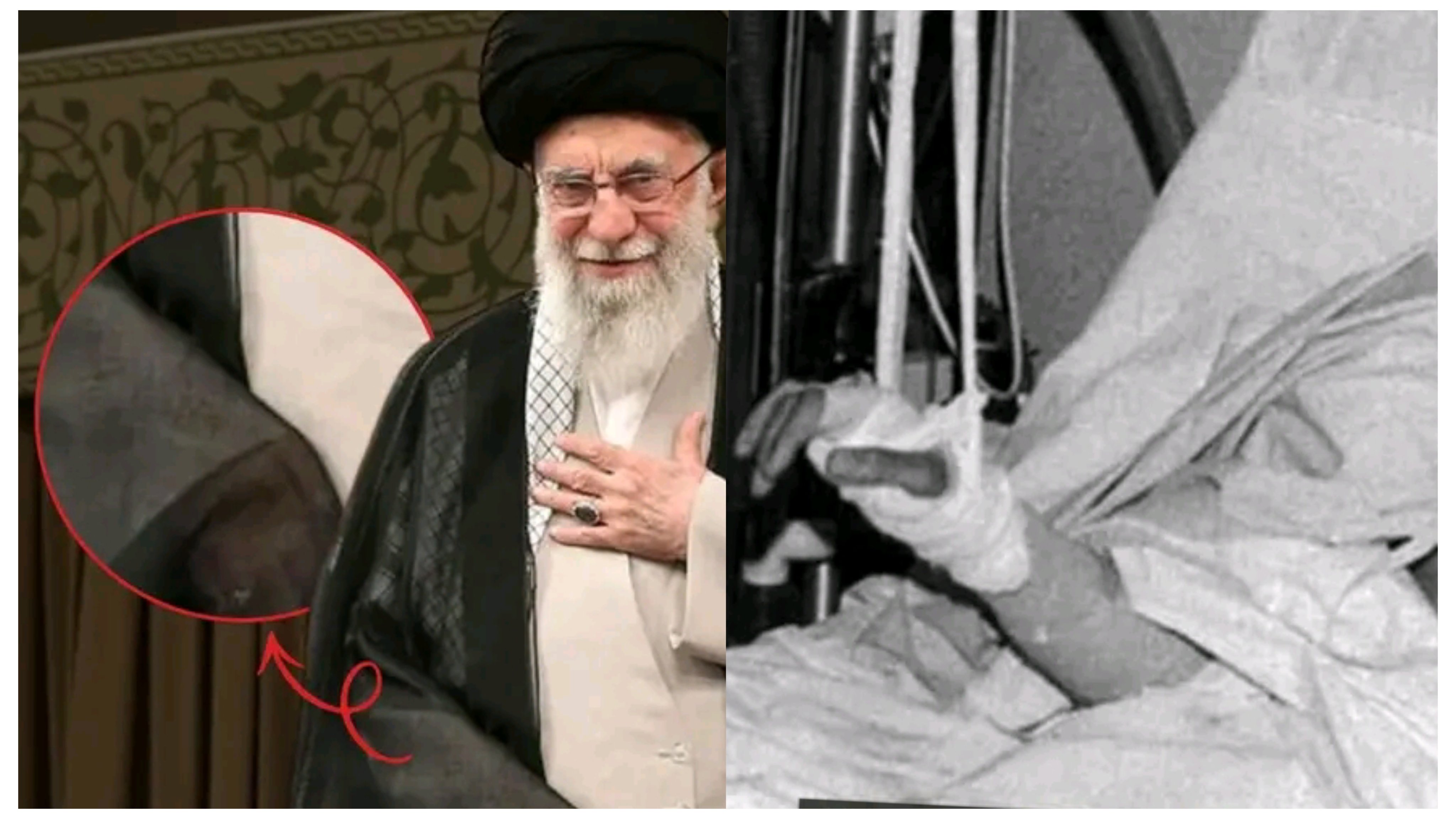 ފޮރުވިފައިވާ އަތުގެ ސިއްރު: އާޔަތުﷲ އަލީ ޚާމަނާއީގެ ފުރާނަ ސަލާމަތްވި ހާދިސާ