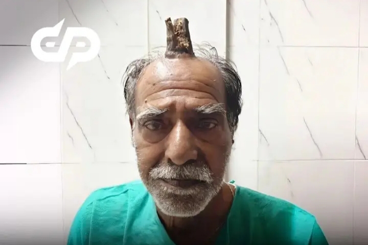 "ޝައިތާނާގެ ދަޅު": އާދަޔާ ހިލާފު ސިއްހީ ހާލަތަކަށްފަހު އިންޑިއާ މީހެއްގެ އޮޕަރޭޝަން ކާމިޔާބު