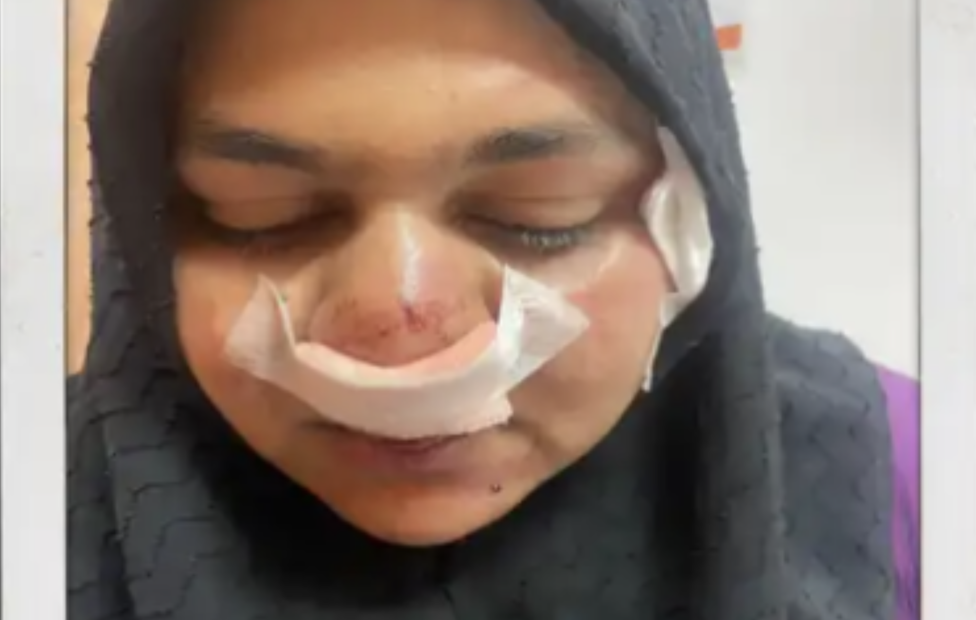 އެމްޑީޕީގެ ކެންޑިޑޭޓް ސިބާއަށް އަނިޔާވީ އެކްސިޑެންޓެއްގެ ސަބަބުން: ފުލުހުން