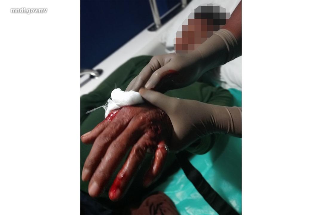 މިޔަރެއް ދަތް އަޅައިގެން މަސްވެރިއަކަށް ފަރުވާ ދެނީ