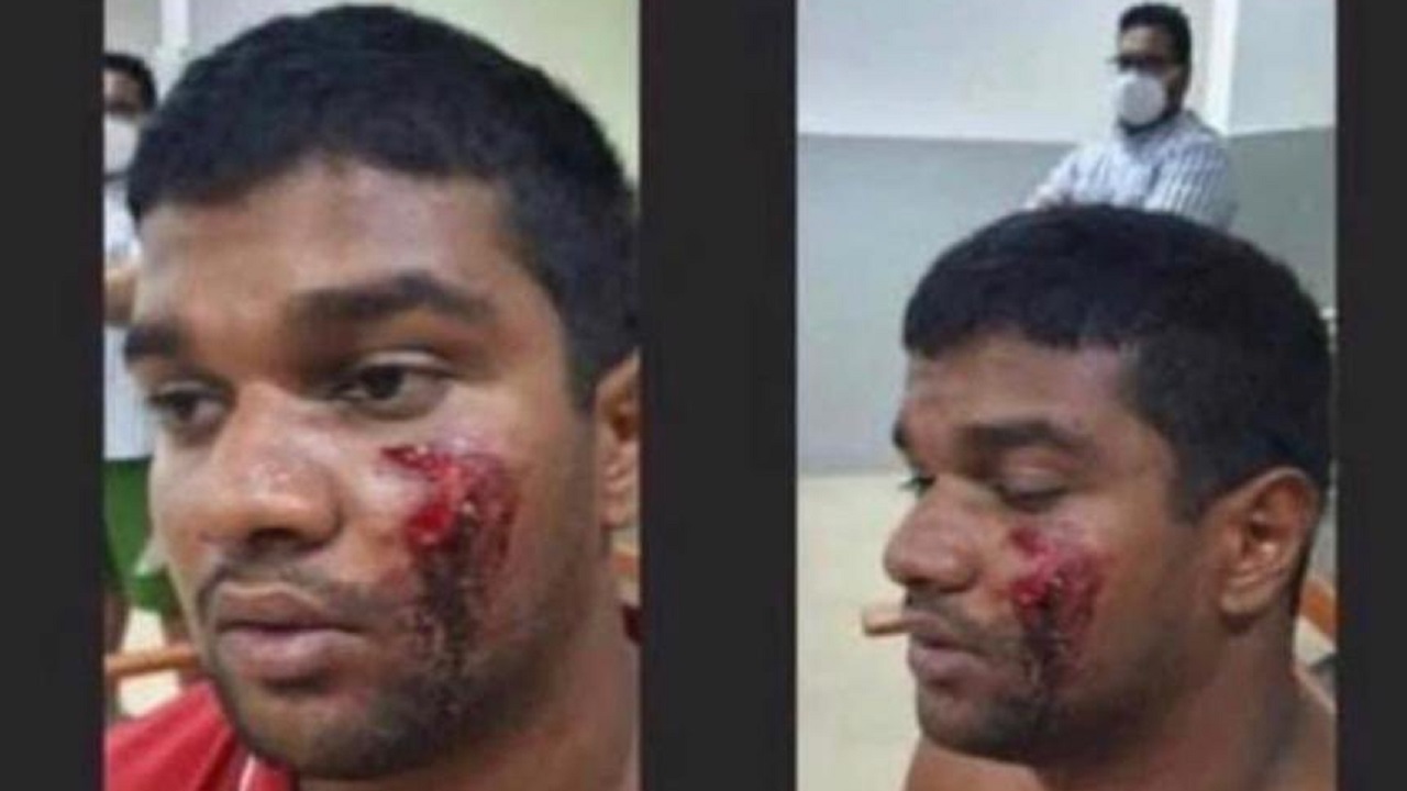 ފުލުހުން އަނިޔާކުރި ކަމަށްބުނެ އިދިކޮޅުން ދައުރު ކުރަނީ ފޭކް ފޮޓޯއެއް: ސީޕީ