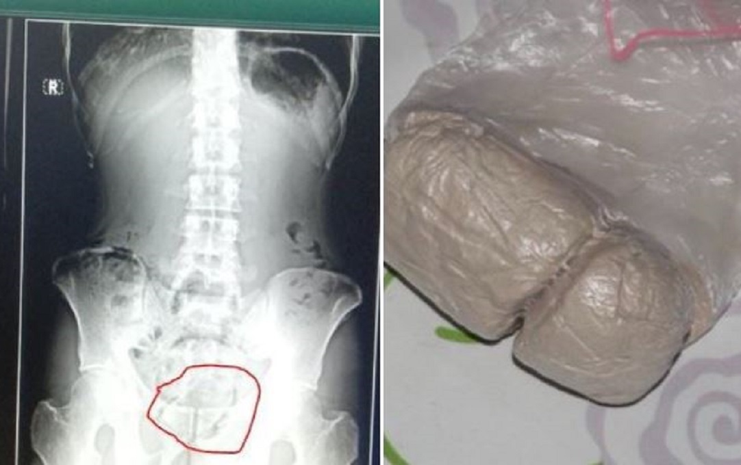 ޖަލަށް ގެންދިޔަ ގައިދީއެއްގެ ފުރަގަސްފަރާތުގައި ފޮރުވާފައިހުރި މަސްތުވާތަކެތި ހޯދައިފި