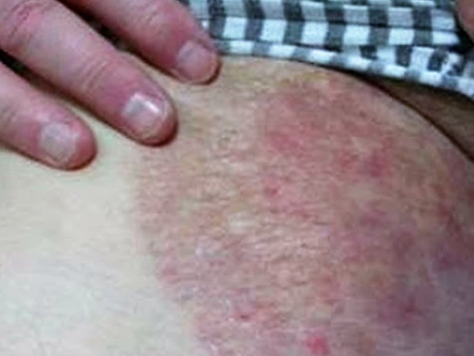 ޖޮކް އިޗް ބަލި - ހަމައެކަނި ފިރިހެނުންނަށް ޖެހޭ ބައްޔެއް ނޫން އަންހެނުންވެސް ޖެހޭ