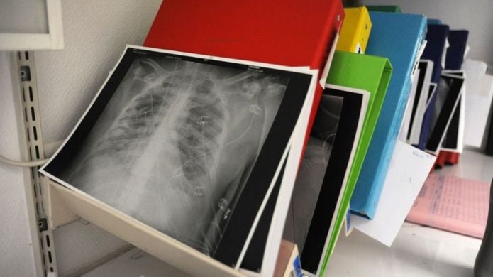 ފުރަތަމަ ފަހަރަށް ދިރިހުރި މީހެއްގެ ފުއްޕާމޭ ހަދިޔާކޮށްގެން ފުއްޕާމޭ ބަދަލުކޮށްފި