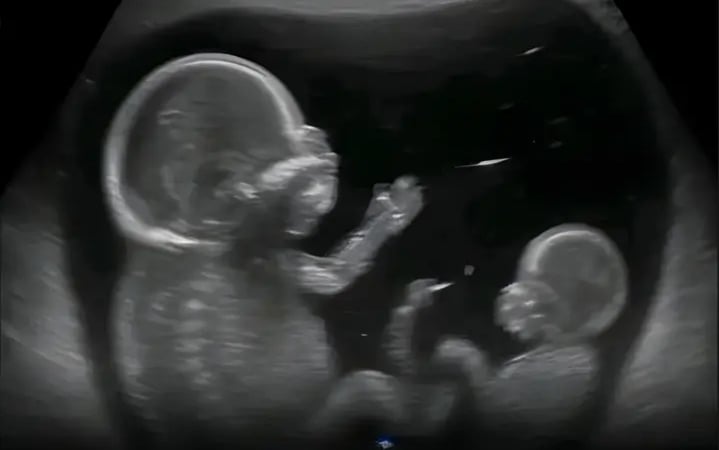 ރަހިމެއްގައި ތަފާތު ދެ އުމުރެއްގެ ދެ ފުރާނަ: ދުނިޔެއިން މަދުން ނޫނީ ނުފެންނަ ކަމެއް