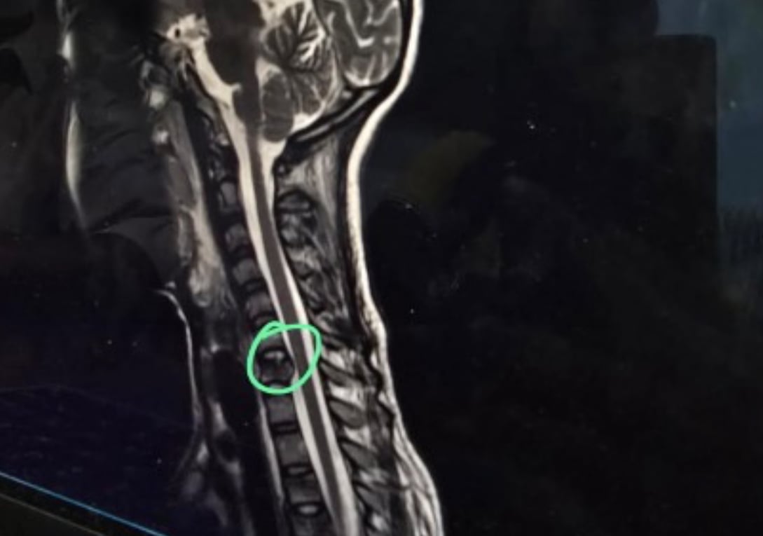 ޔުމްނު ކުރަންޖެހުނު އެންމެ ނުރައްކާތެރި އޮޕަރޭޝަން ކާމިޔާބު: އާއިލާ