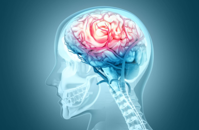 ސައިލެންޓު ބްރެއިން ސްޓްރޯކު