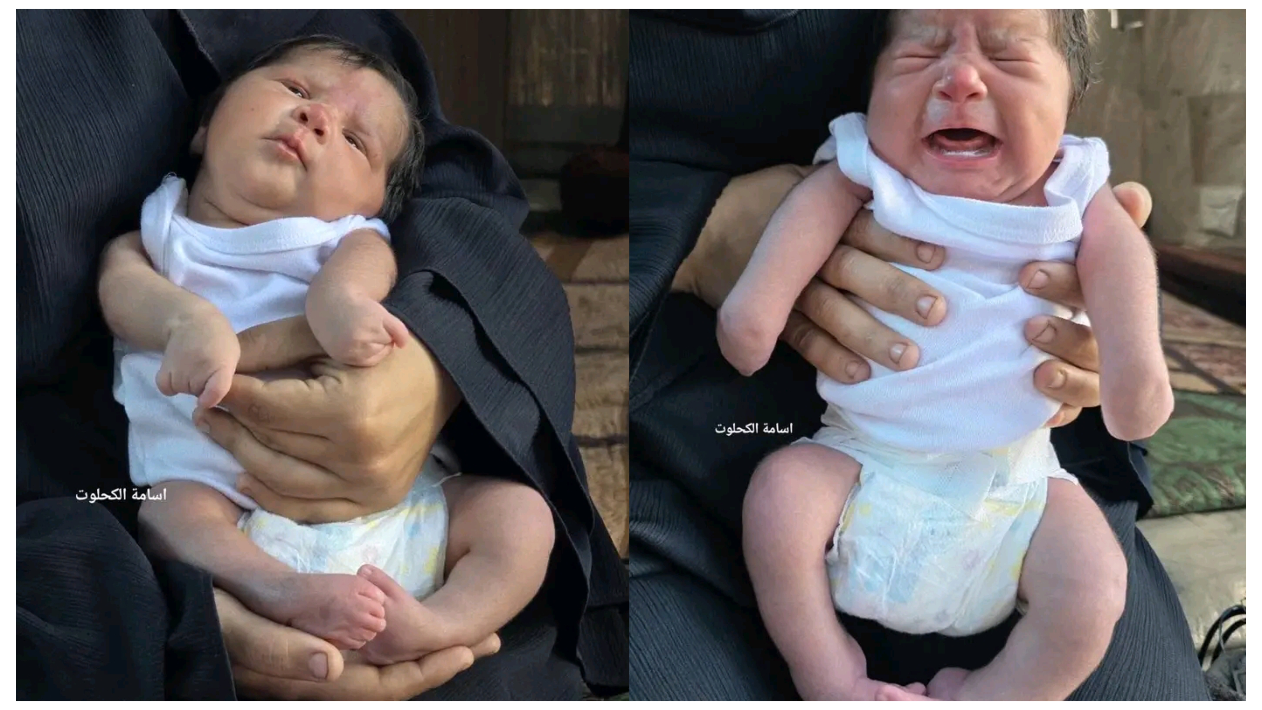 ގާޒާގެ ކުޑަކުދިންގެ މެދުގައި އައިބުތަކާއެކު އުފަންވާ މިންވަރު އިތުރުވުމުގެ ބިރުވެރިކަން ބޮޑުވެއްޖެ