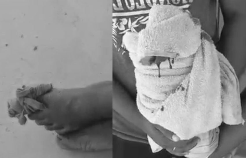 މަސްދޯންޏަކުން މޫދަށް ވެއްޓުނު މީހަކަށް މިޔަރެއް ޙަމަލާދީފި