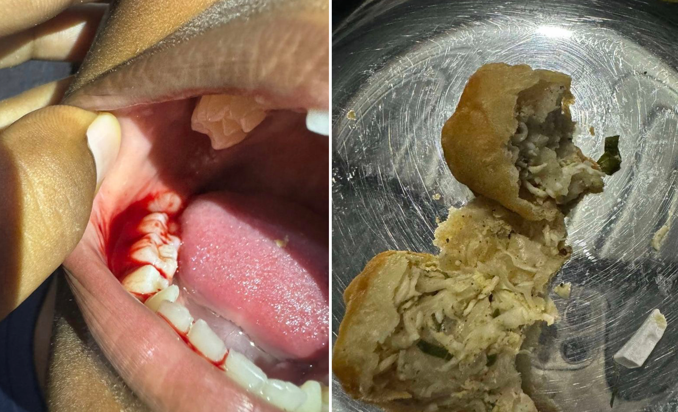 ގދ. ތިނަދޫ ފިހާރައަކުން ވިއްކި ހެދިކާއެއްގެ ތެރޭގައި ފުޅިތޮށި