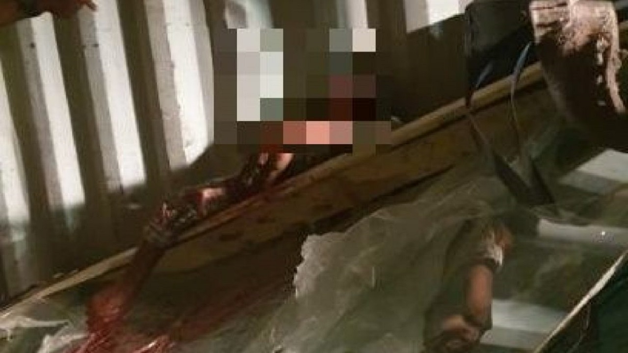 އެމްޕީއެލްގައި ބިއްލޫރި ޕެލެޓެއް ވެއްޓި ދެ މީހަކަށް ސީރިއަސް އަނިޔާތަކެއް