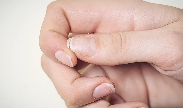 ހަށިގަނޑަށް ބޭނުންވާ ވަރަށް ނިއުޓްރިއެންޓު ނުލިބޭ ކަމުގެ ނިޝާންތައް