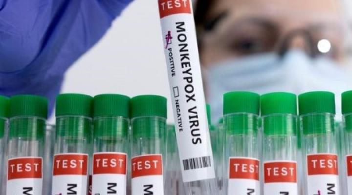 އަވަށްޓެރި ލަންކާއިން ފުރަތަމަ ފަހަރަށް މަންކީޕޮކްސް ބަލި ފެނިއްޖެ