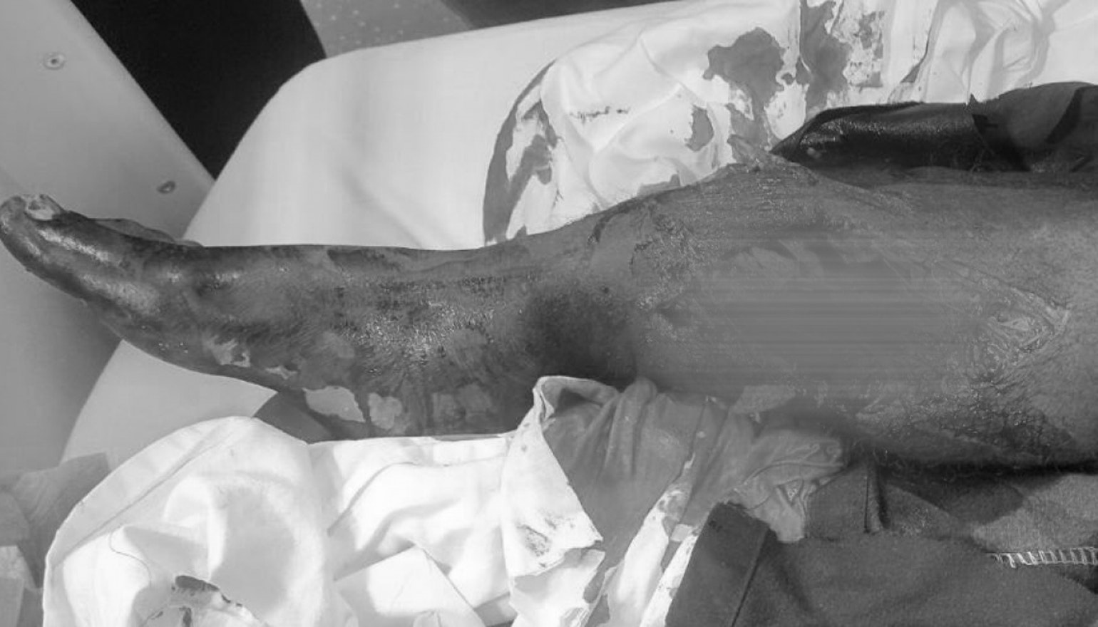 ތިލަފުށީގައި ހިނގި ނުރައްކާތެރި އެކްސިޑެންޓެެއްގައި 3 މީހަކަށް އަނިޔާވެއްޖެ