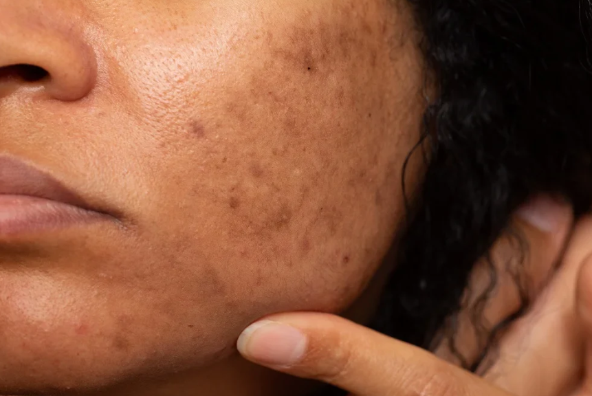 ހަންގަނޑުގައި ހުންނަ ކަޅު ތަންތަން ފިލުވާލުމަށް ގޭގައި ކުރެވިދާނެ ކަންކަން