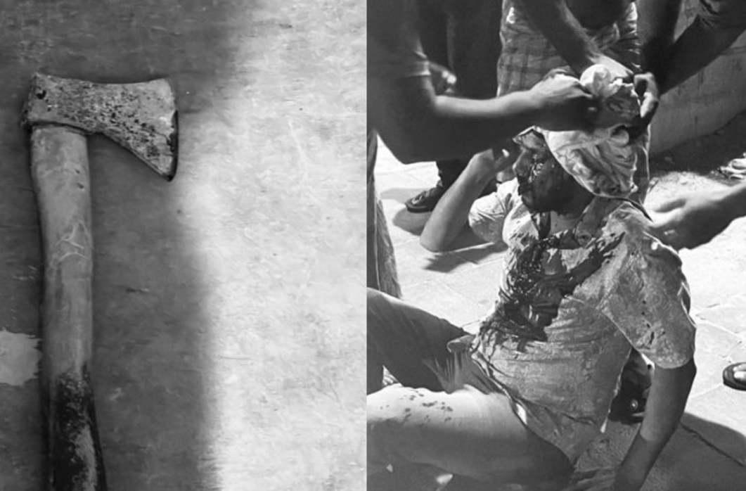 ގެއަކުން ވައްކަންކުރަން އުޅުނު މީހަކަށް ކޯރާޑިއަކުން ހަމަލާދީ ބޯ ފަޅާލައިފި